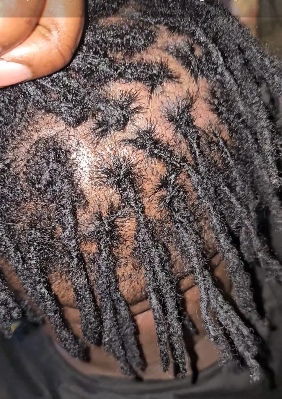 locs